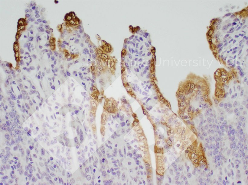 Figura 1. Tinción IHC de DEP en intestino delgado infectado. Fuente: Iowa State University VDL.
