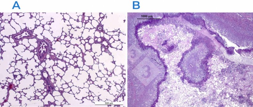 Abb. 2: Hämatoxylin- und Eosinfärbung in einer normalen (A) und einer geschädigten (B) Lunge. Die Lunge in B ist von einer fibrinös-nekrotisierenden Pleuropneumonie betroffen, die durch Actinobacillus pleuropneumoniae verursacht wurde.